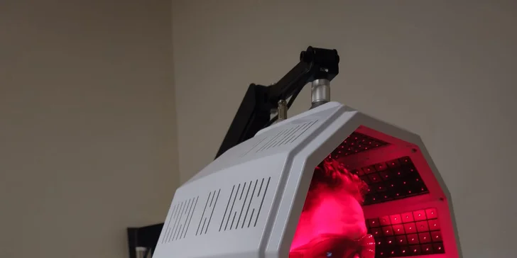 Brilliance Hair Therapy – laserová vlasová terapia novej generácie