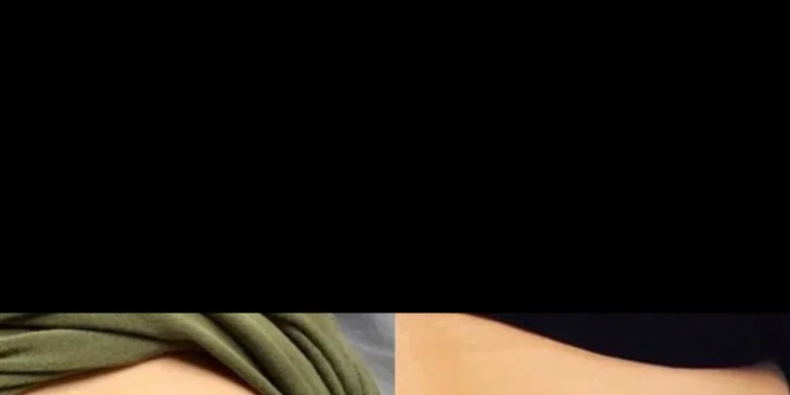 Mezoterapia tváre či pokožky hlavy alebo microneedling na odstránenie jaziev