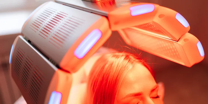 Brilliance Hair Therapy – laserová vlasová terapia novej generácie