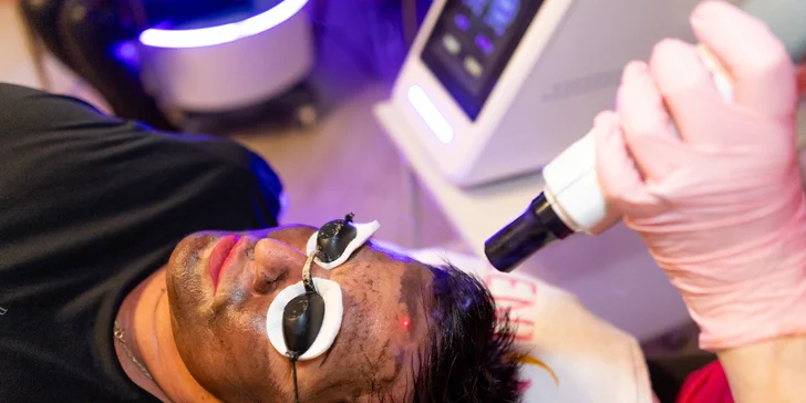 Hollywood Carbon Peel pre rozžiarený a jednotný tón pleti