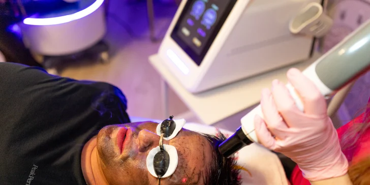 Hollywood Carbon Peel pre rozžiarený a jednotný tón pleti