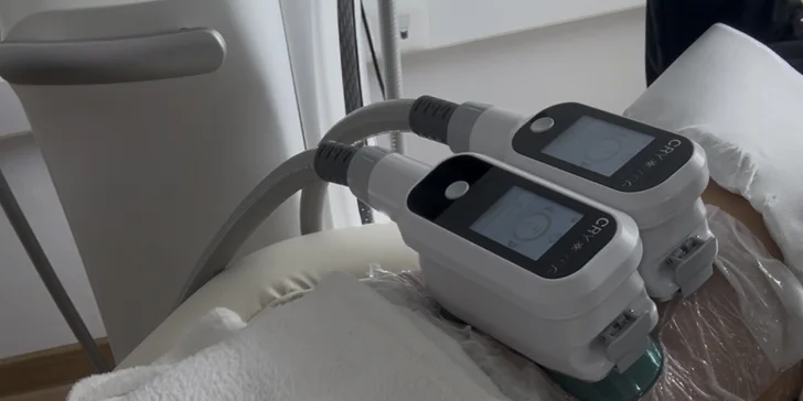 Tvarovanie postavy pomocou kryolipolýzy a EMS