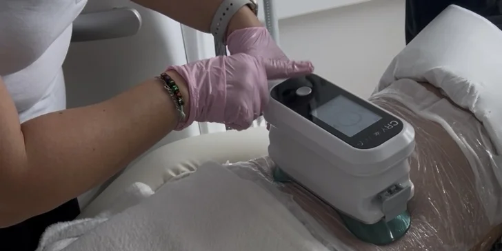 Tvarovanie postavy pomocou kryolipolýzy a EMS