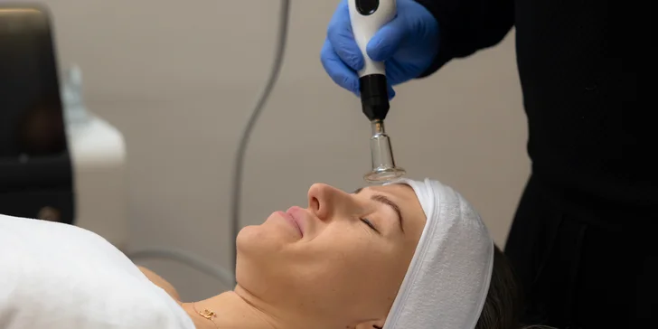 Účinná laserová liečba akné studenou plazmou