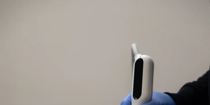 Účinná laserová liečba akné studenou plazmou