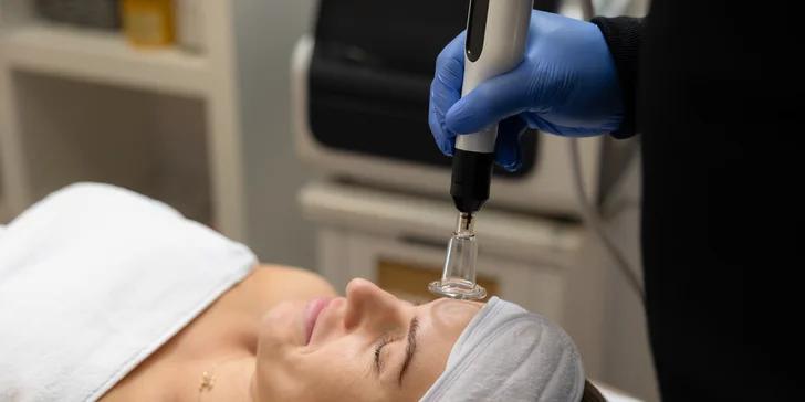 Účinná laserová liečba akné studenou plazmou