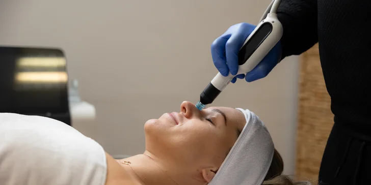 Účinná laserová liečba akné studenou plazmou