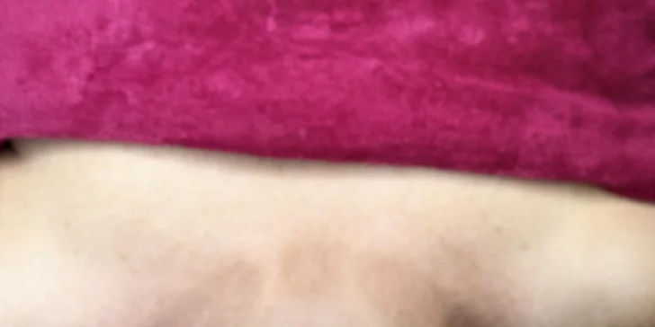 Omladenie aj bez botoxu: Exozómy a vodíkové čistenie pleti