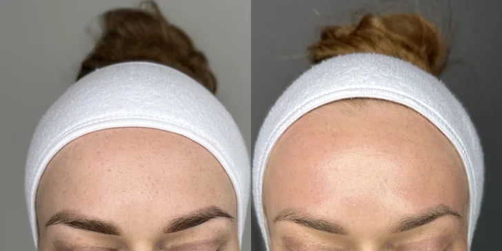 Bio-ihly z morských rias pre hladkú pleť bez akné