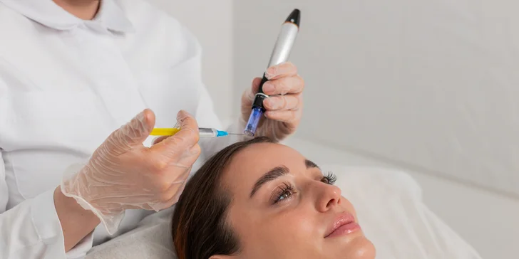 Vlasová mezoterapia mikroihličkovaním: podpora rastu a zdravia vlasov