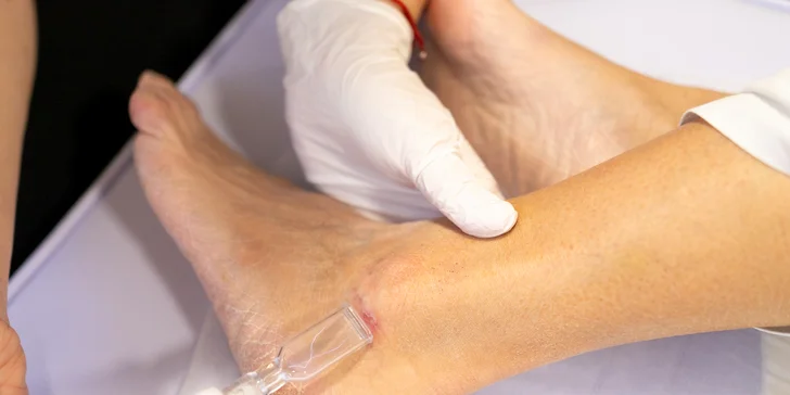 Plazma Fusion: zbavte sa jaziev, vrások alebo podporte rast vlasov a zregenerujte pleť