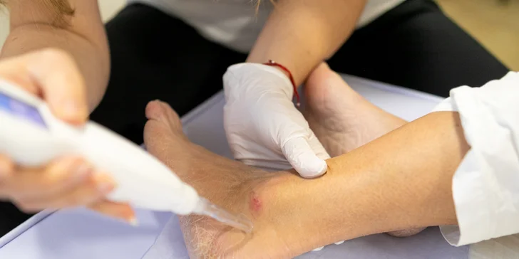 Plazma Fusion: zbavte sa jaziev, vrások alebo podporte rast vlasov a zregenerujte pleť