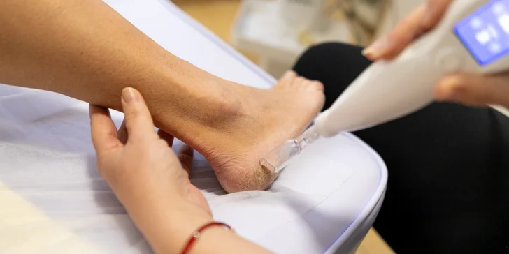 Plazma Fusion: zbavte sa jaziev, vrások alebo podporte rast vlasov a zregenerujte pleť