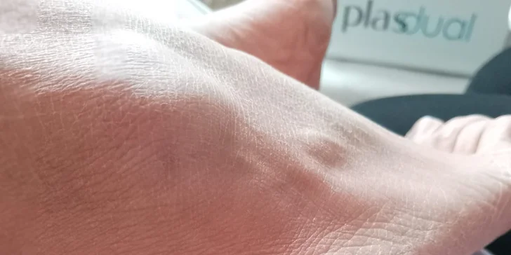 Plazma Fusion: zbavte sa jaziev, vrások alebo podporte rast vlasov a zregenerujte pleť