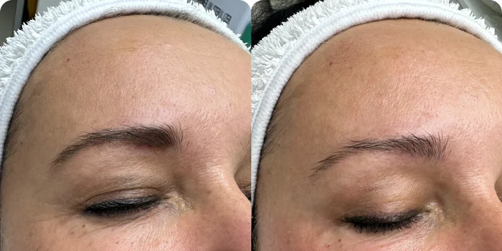 Bio-ihly z morských rias pre hladkú pleť bez akné