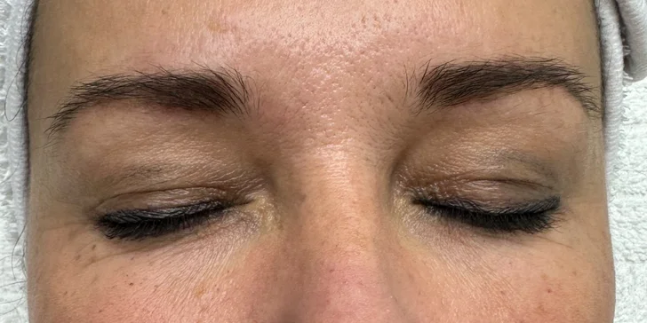 Bio-ihly z morských rias pre hladkú pleť bez akné