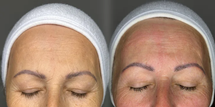 Bio-ihly z morských rias pre hladkú pleť bez akné