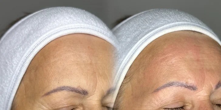 Bio-ihly z morských rias pre hladkú pleť bez akné