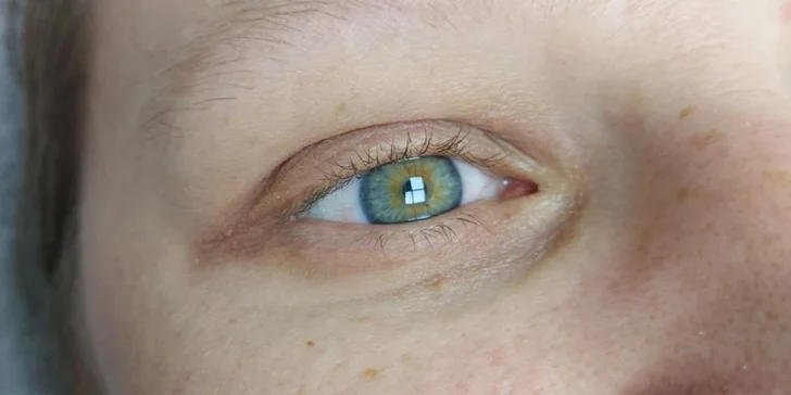 Prirodzene pôsobiace zahustenie mihalníc (1D alebo 2D mihalnice), laminácia obočia či lash lift