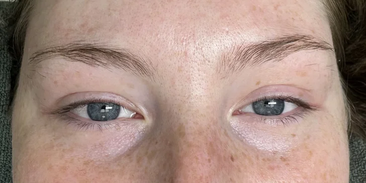 Prirodzene pôsobiace zahustenie mihalníc (1D alebo 2D mihalnice), laminácia obočia či lash lift