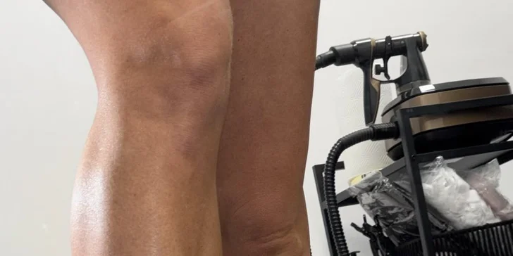 Cukrový nástrek: krásne a bezpečné opálenie bez UV žiarenia