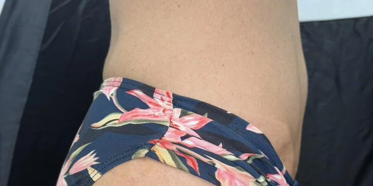 Cukrový nástrek: krásne a bezpečné opálenie bez UV žiarenia