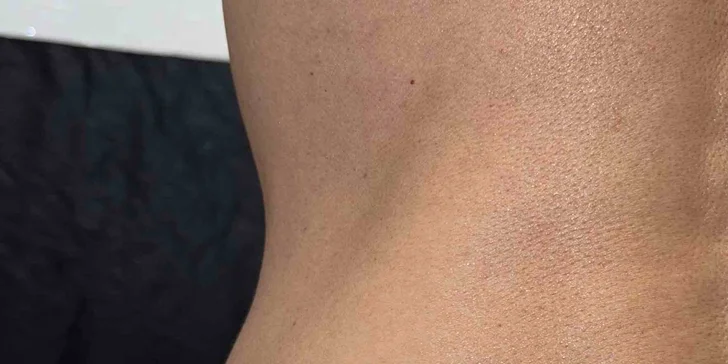 Cukrový nástrek: krásne a bezpečné opálenie bez UV žiarenia