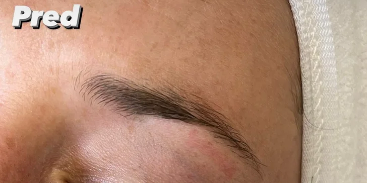 Lash lift mihalníc, laminacia obočia alebo výhodný balíček v Anzu Cosmetics