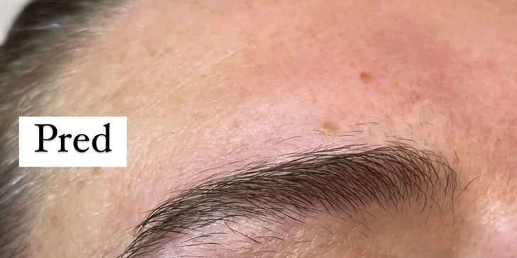 Lash lift mihalníc, laminacia obočia alebo výhodný balíček v Anzu Cosmetics