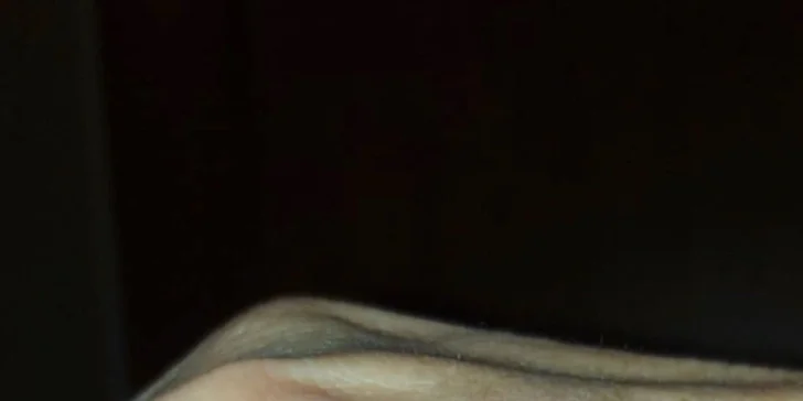 Plazma Fusion: zbavte sa jaziev, vrások alebo podporte rast vlasov a zregenerujte pleť