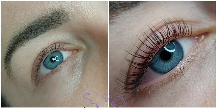 Neodolateľný pohľad s novými 2D–9D Hollywood mihalnicami či lashliftom mihalníc