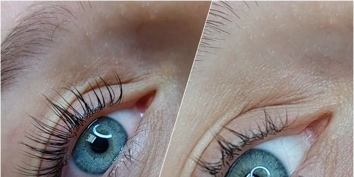 Neodolateľný pohľad s novými 2D–9D Hollywood mihalnicami či lashliftom mihalníc