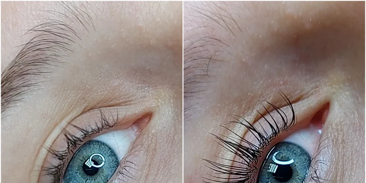 Neodolateľný pohľad s novými 2D–9D Hollywood mihalnicami či lashliftom mihalníc