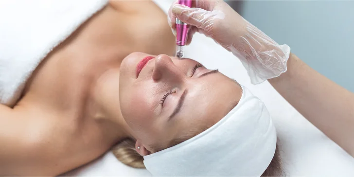 Frakčná mikroihličková rádiofrekvencia tváre, krku a dekoltu