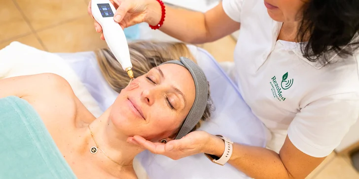 Kozmetické ošetrenie tváre prístrojom Plazma Fusion na klinike RezoMed