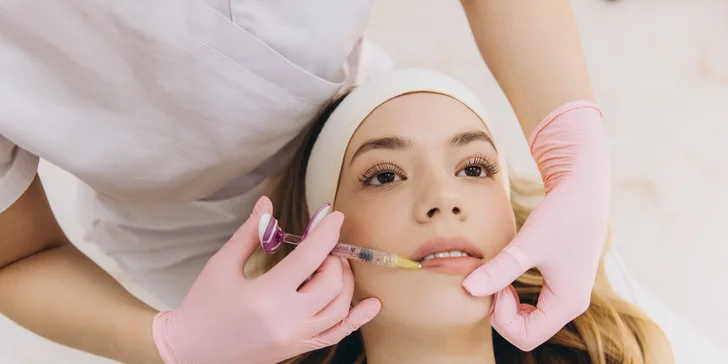 Výplň a modelácia pier kyselinou hyalurónovou: prirodzene tvarované a hydratované pery