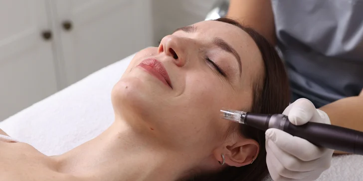 Mezoterapia PDRN: intenzívne omladenie pleti s lososovou DNA