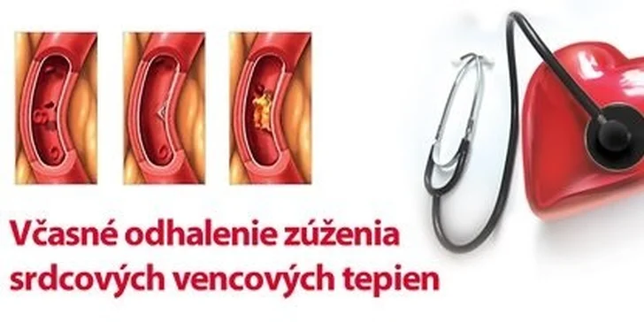 Prevencia srdcového infarktu a mozgovej príhody včasnou diagnostikou