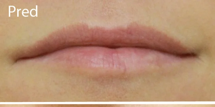 Permanentný Make - up obočia čiarkovanou metódou alebo kontúra pier s jemným tieňovaním