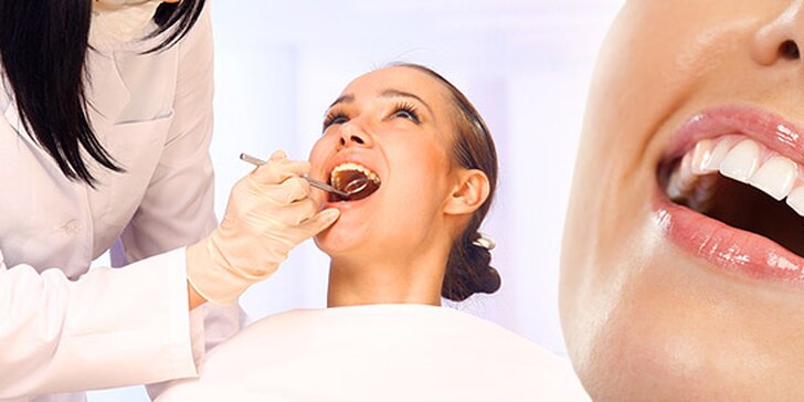 Vstupná prehliadka s dentálnou hygienou v ambulancii Dentalissimo