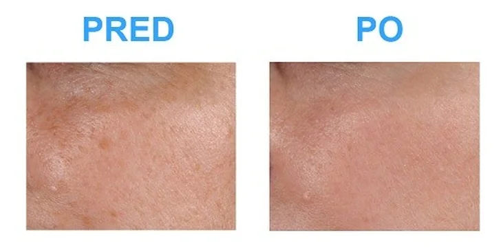 Omladenie pleti v centre plastickej chirurgie