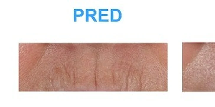 Omladenie pleti v centre plastickej chirurgie