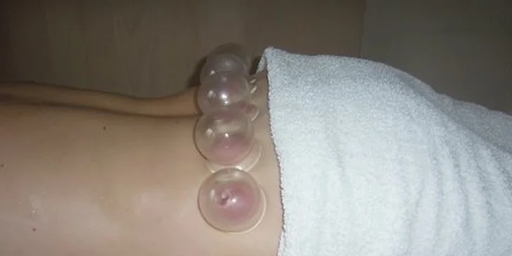 Klasická, kombinovaná masáž s bankovaním alebo reflexná masáž chodidiel a svetelná terapia