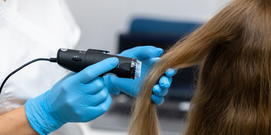 Trichologické vyšetrenie vlasov a pokožky hlavy aj s návrhom liečby