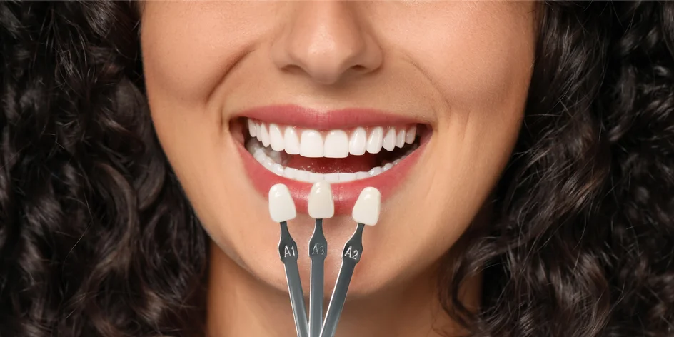 Dentálna hygiena – samostatne aj v kombinácii s bielením zubov