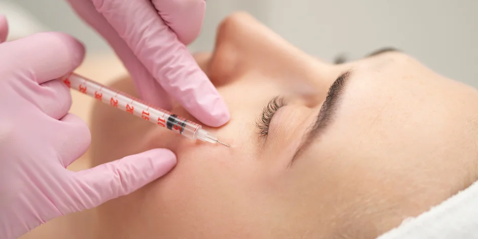 Mezoterapia alebo bioregenerácia microneedling očného okolia