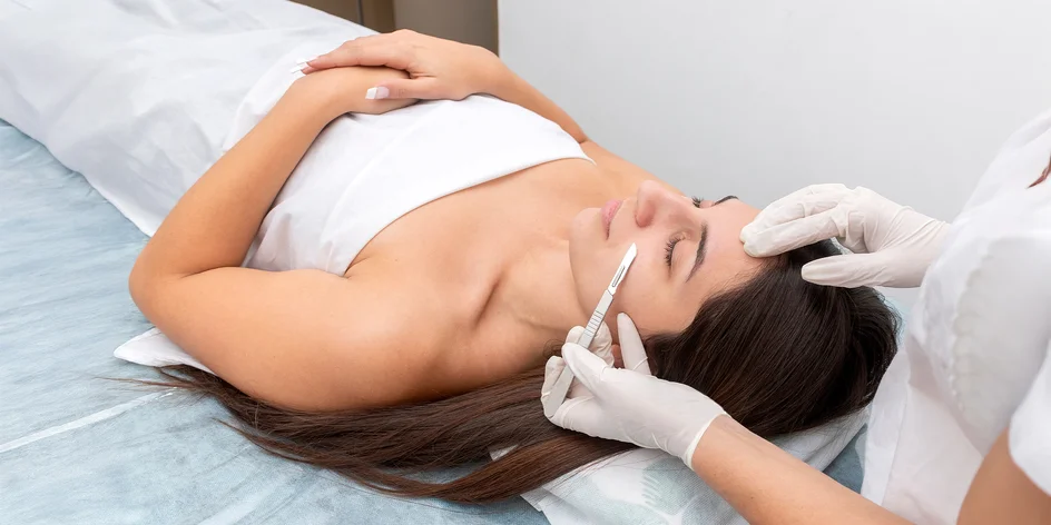 Profesionálna exfoliácia tváre pomocou Skin glow DERMAPLANINGU