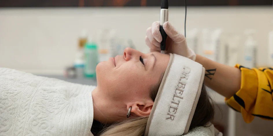 Mezoterapia tváre aj s hydratáciou pier kyselinou hyalurónovej